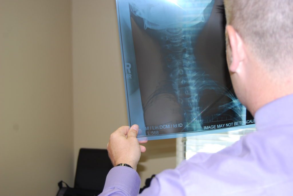 Synergy Chiropractic of Houston - Neck Pain